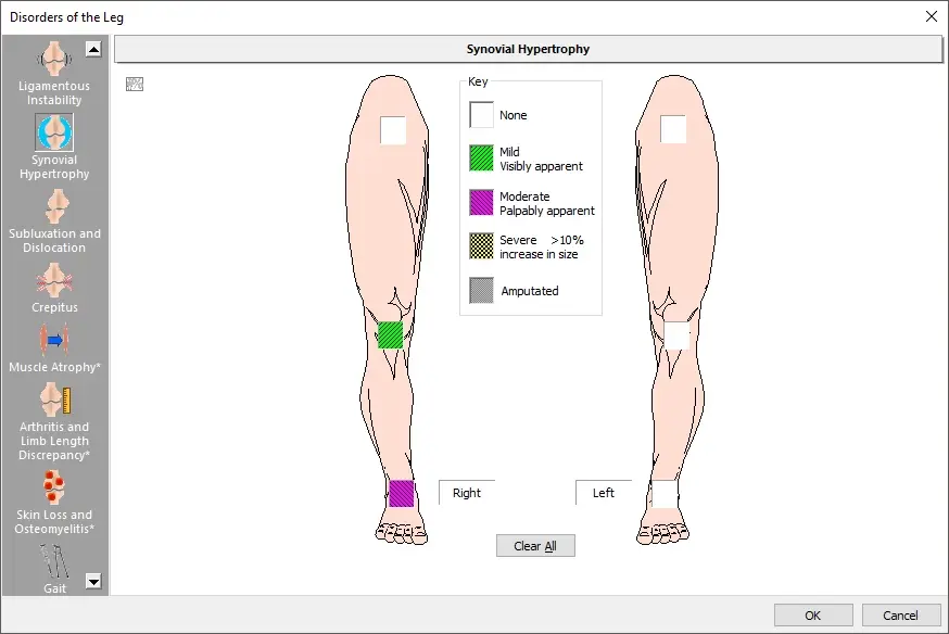 disorders-leg